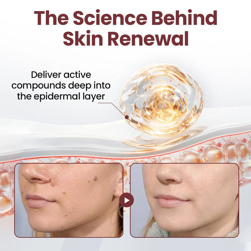 mistsilt®KeraErase Dual-Action Renewal Cream
