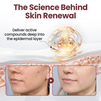 mistsilt®KeraErase Dual-Action Renewal Cream
