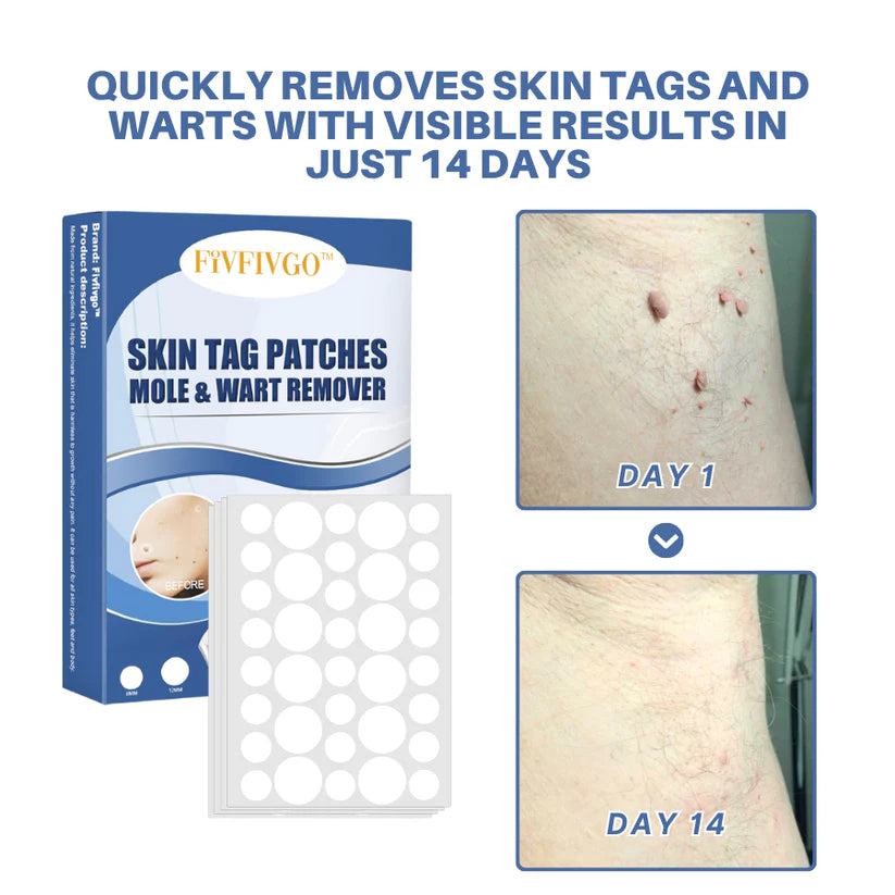 mistsilt® Moles & Warts Removing Skin Tag Patch