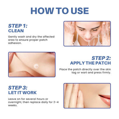mistsilt® Moles & Warts Removing Skin Tag Patch