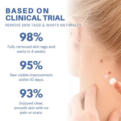 mistsilt® Moles & Warts Removing Skin Tag Patch