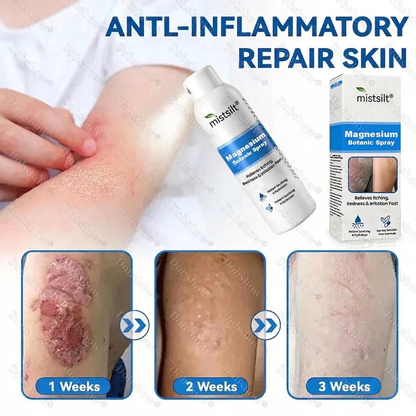 mistsilt® Magnesium Botanic Spray – Advanced Skin Recovery for Psoriasis & Eczema | Rapid Soothing, Steroid-Free
