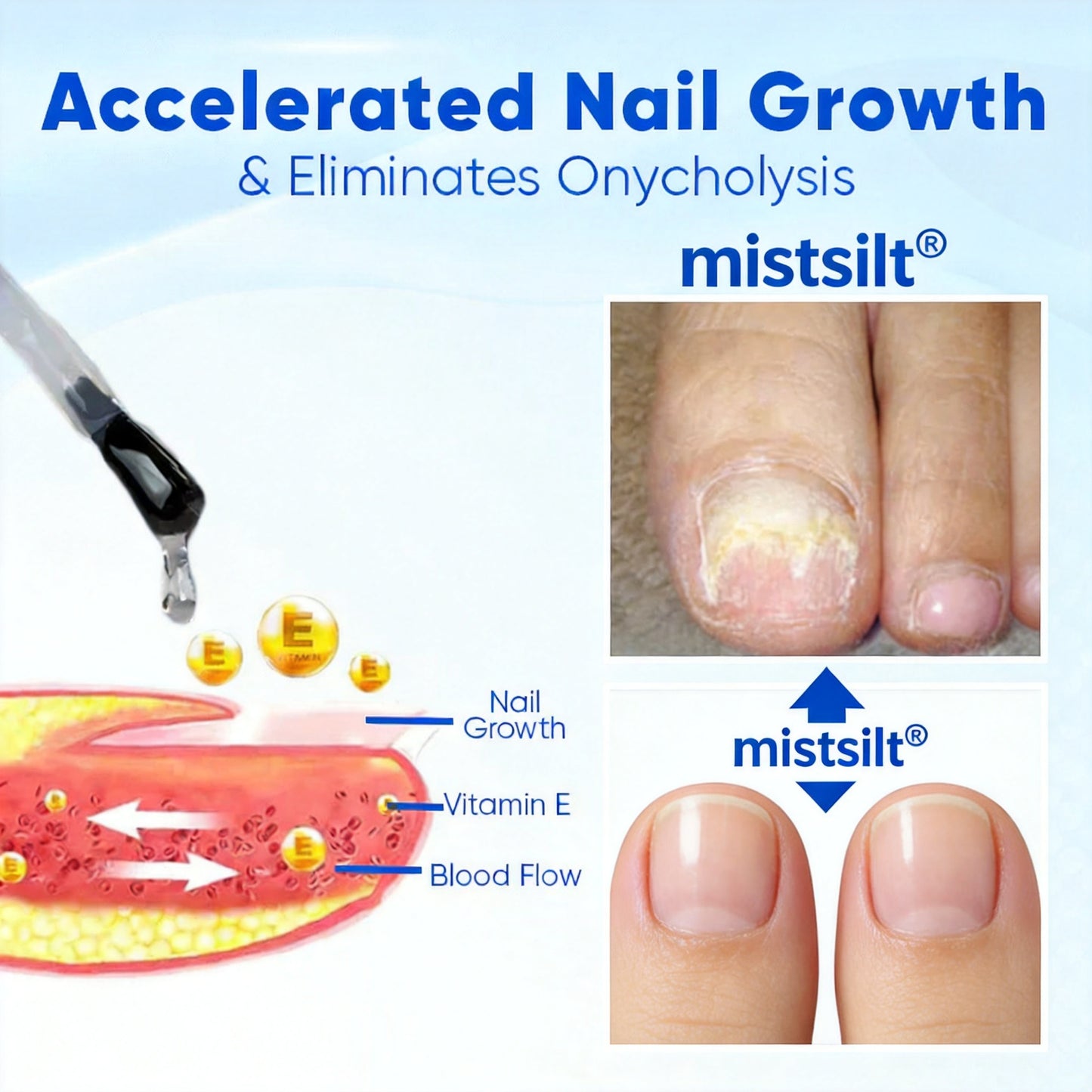 Mistsilt® OnyxoGuard Nail Growth and Repair Serum