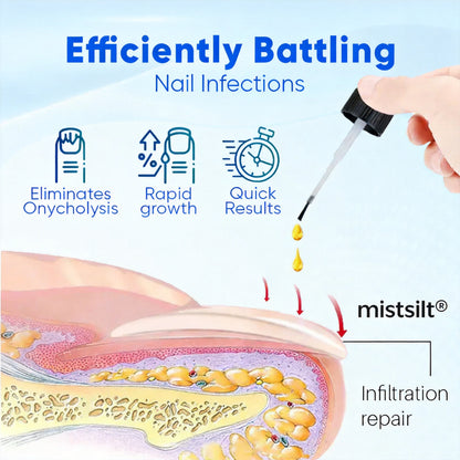 Mistsilt® OnyxoGuard Nail Growth and Repair Serum