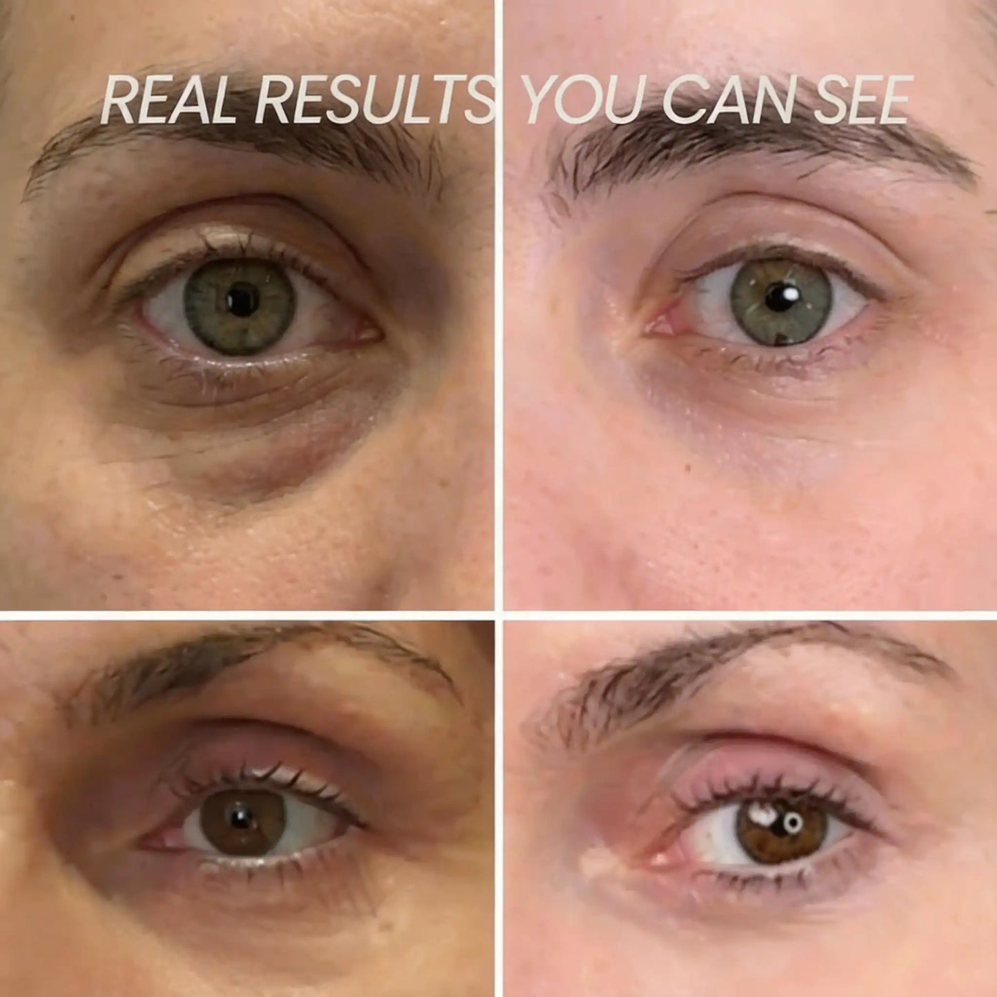Transform Wrinkles, Fine Lines, And Tired Creases Naturally