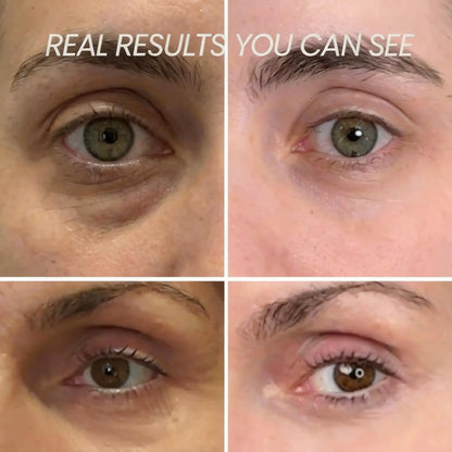 Transform Wrinkles, Fine Lines, And Tired Creases Naturally