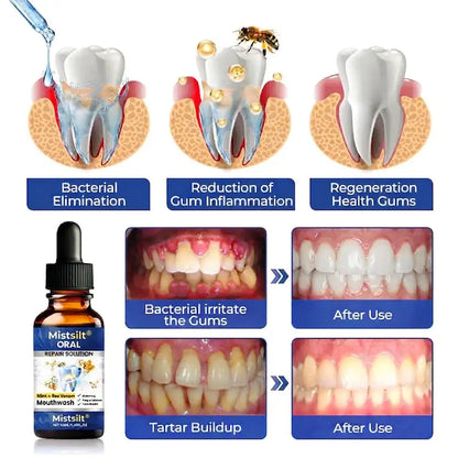 Mistsilt® Oral Repair Mouthwash – Mint + Bee Venom Formula | Whitening, Plaque Defense & Fresh Breath