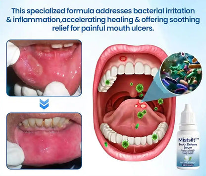 Mistsilt™ NanoHAP Tooth Defense Serum