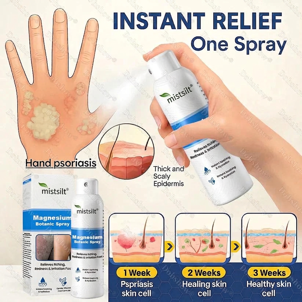 mistsilt® Magnesium Botanic Spray – Advanced Skin Recovery for Psoriasis & Eczema | Rapid Soothing, Steroid-Free
