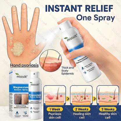 mistsilt® Magnesium Botanic Spray – Advanced Skin Recovery for Psoriasis & Eczema | Rapid Soothing, Steroid-Free
