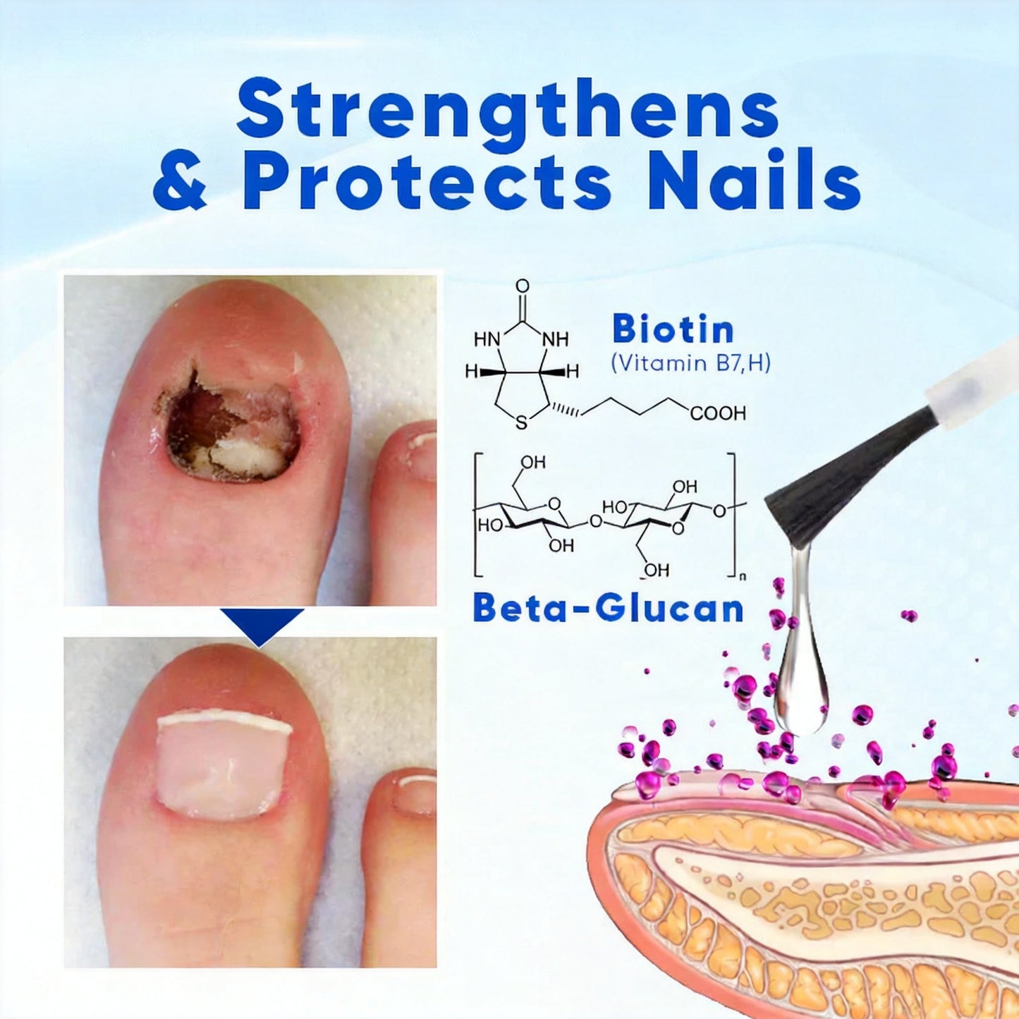 Mistsilt® OnyxoGuard Nail Growth and Repair Serum