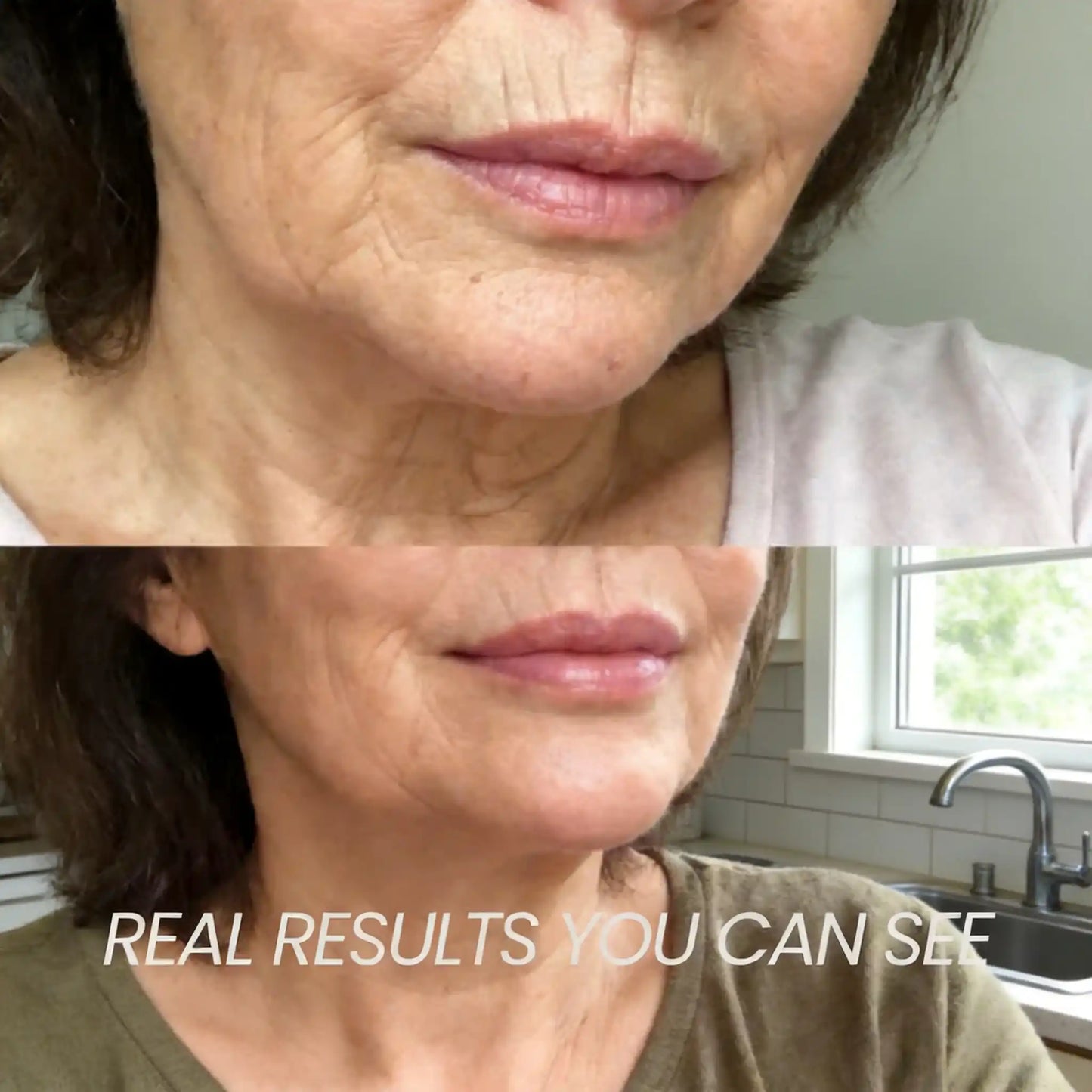 Transform Wrinkles, Fine Lines, And Tired Creases Naturally