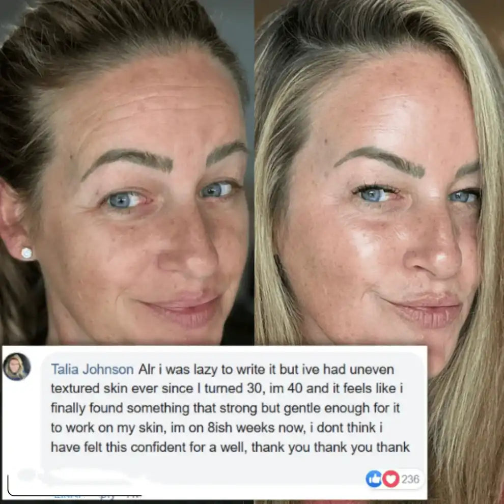 Transform Wrinkles, Fine Lines, And Tired Creases Naturally